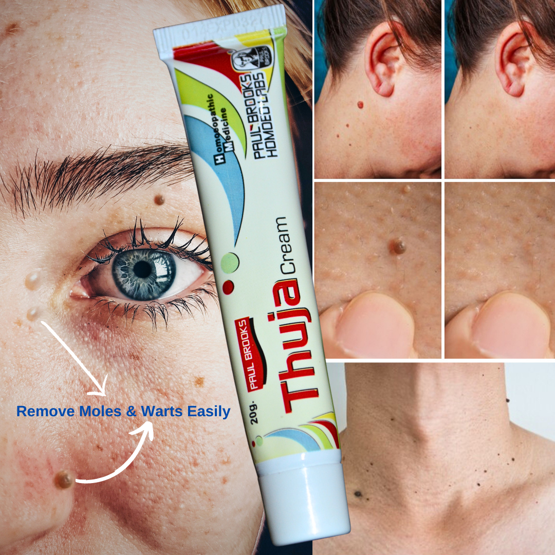 Hot sale100 effective warts remover removal original cream organica