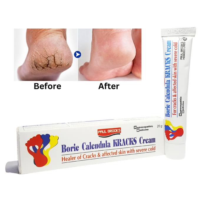 Crack Foot, Heal & Hand Cream