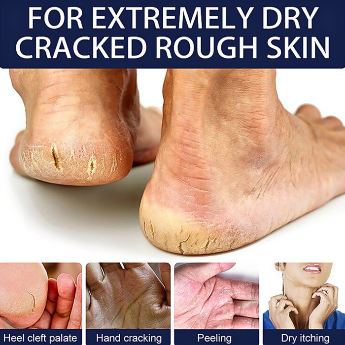 Crack Foot, Heal & Hand Cream