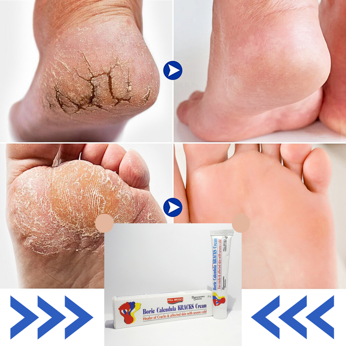 Crack Foot, Heal & Hand Cream